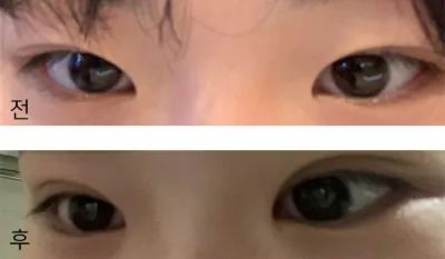 [눈] 쵸키1234 - 눈