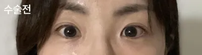 [눈] ㅈㅎㅊ - 눈