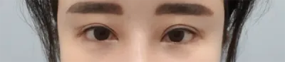 [눈] 끼멤 - 눈
