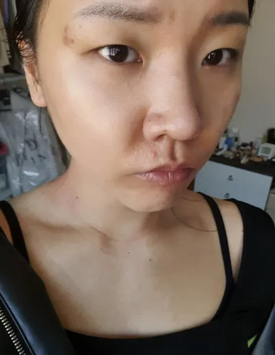 [눈] 빈나빛나 - 절개, 트임