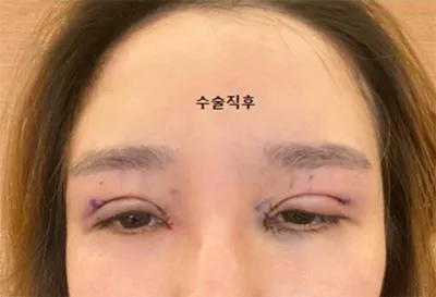 [눈] 나으리으리 - 눈