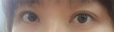 [눈] 보보보보1234 - 눈