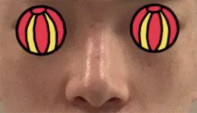 [코] 혀니9801 - 코