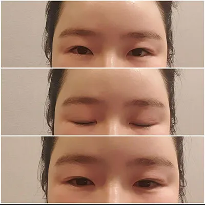 [눈] appleseh - 눈