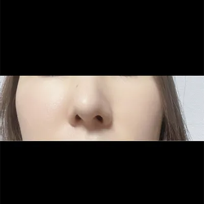 [코] 232323 - 코