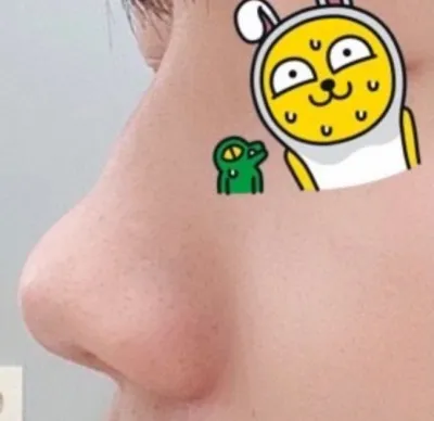 [코] 비숑숑숑숄 - 코