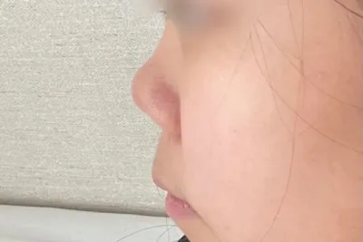 [코] 전지현2 - 콧대