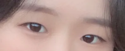 [눈] 0202u - 윗트임, 쌍꺼풀