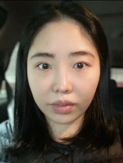 [안면윤곽] 마샬스피커 - 윤곽3종