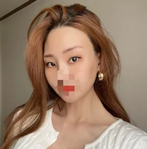 [안면윤곽] love_01 - 윤곽