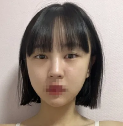 [눈] 동글e - 눈