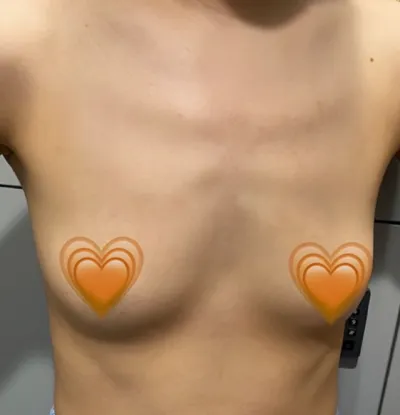 [가슴] 탱탱볼 - 가슴