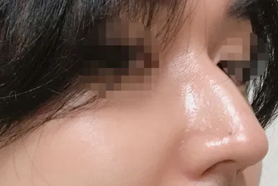 [코] 로봇 - 코