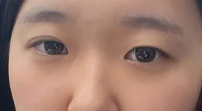 [눈] 마이멜로디 - 눈,코