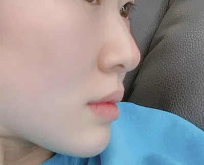 [코] 첫사랑 - 코