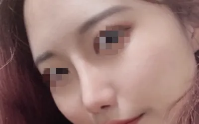 [코] 문문이 - 코