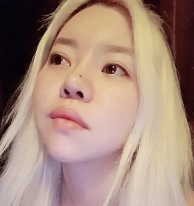 [눈] 뀩꺅 - 눈,코,지방이식