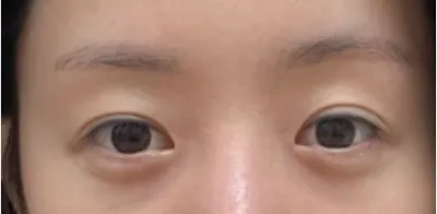 [눈] 삼만리 - 눈