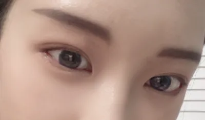 [눈] 루디루다 - 눈