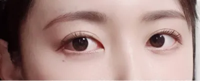 [눈] 라이언춘식 - 눈