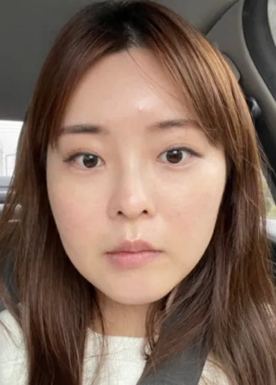 [안면윤곽] 닥터모이아 - 눈,윤곽,코,얼굴지방흡입