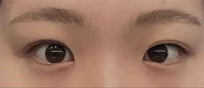 [눈] 밍루루루룩 - 눈