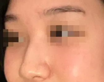 [코] 감기죠심 - 코