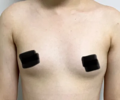 [가슴] 가팅가 - 가슴