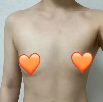 [가슴] 센트리 - 가슴