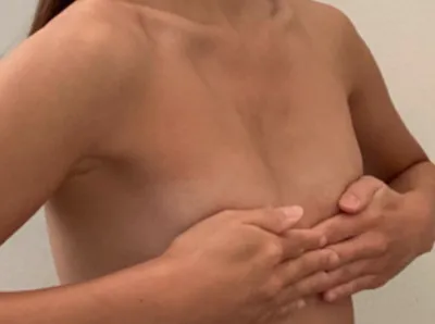 [가슴] 레몬트링킼 - 가슴