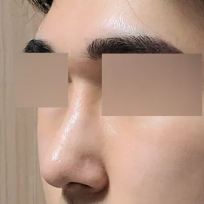 코 한 달 차 후기입니다