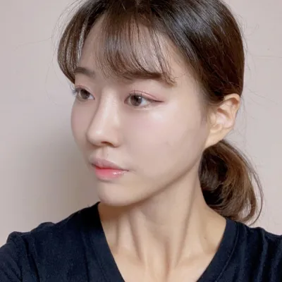 위버스 성형외과에서 코 재수술 받은지 두 달 됐습니당