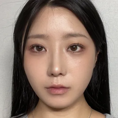 수술한지 한달차입니다~