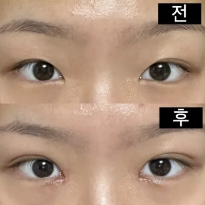 전/후 모두 기본 카메라로 찍었어요!