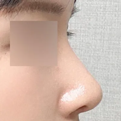 주변에서도 너무 잘됐다고 이쁘다고