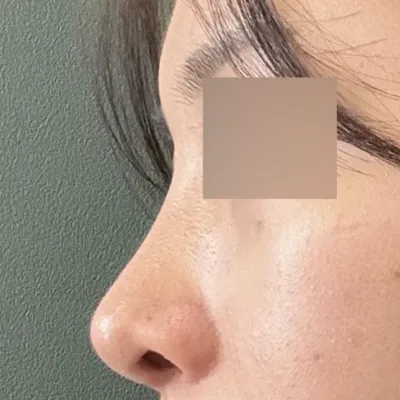 다시 하라고 한다면 100프로 서승조 원장님!!