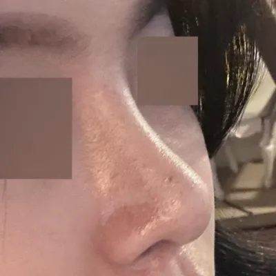 주위에서 코 예쁘다는 소리를 밥 먹듯이 듣고있어요ㅎㅎ