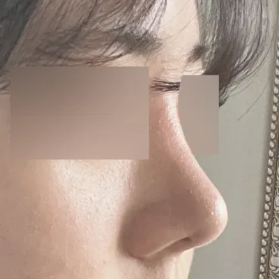 코재수술은 위버스가 짱이예요