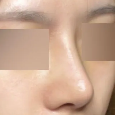 첫수술이지만 성공적인 느낌이 더 많이 드네요