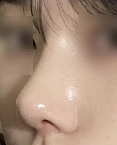 얼굴 비율에 맞는 코를 고려해주시는 점이 특히 좋았습니다요.