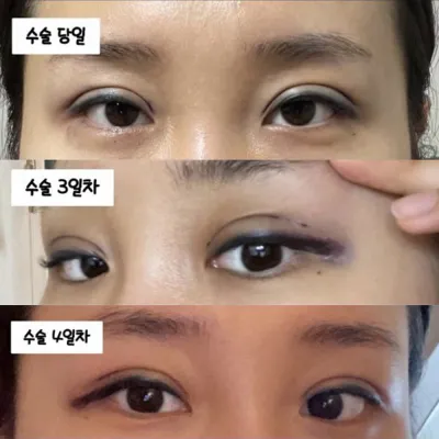 상담때 과하지 않게 잘봐주신다눈,,최고 최고