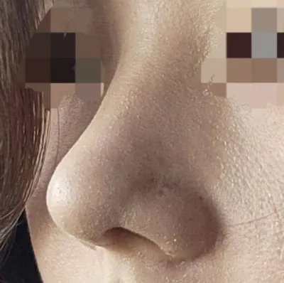 수술결과도 대만족입니다!