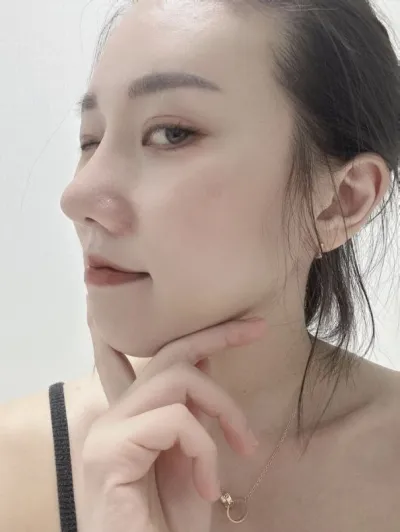 첫 코수술 이정도면 성공 아닌가요?