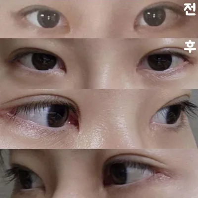 훨씬 답답한 게 없어지고 시원해보여서 너무 만족스럽습니다!