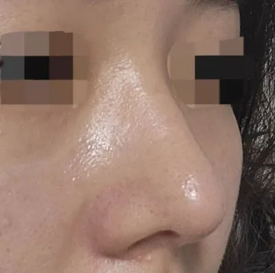 엄청고민하다 진행했는데 돈도 안아깝구 너무행복해요!