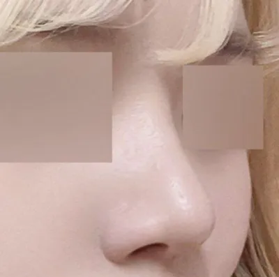 원장님에 대한 믿음감이 없으면 안했을거예요 ㅋㅋ