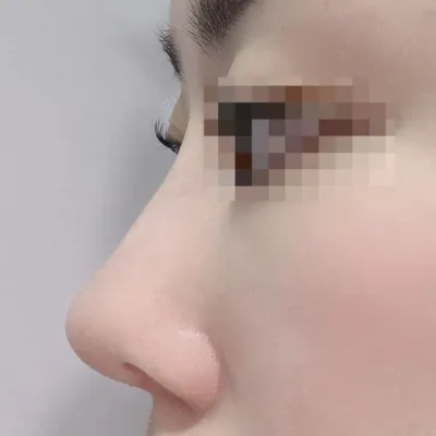 맘에 들어요! 한달 뒤 잔붓기까지 빠졌을 때가 너무 기대되요!