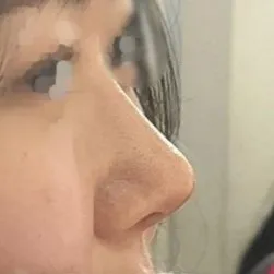 지금 만족도가 너무 높아서 항상 거울 보면서 감탄해요...