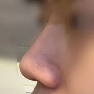 당일예약금 강요도 없어서 상담도 너무 좋았어요!