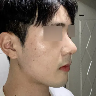 저도 드디어 후기를 올리네요ㅎㅎ